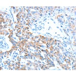 Immunohistochemistry - ALDH5A1 Antibody from Signalway Antibody (37324) - Antibodies.com