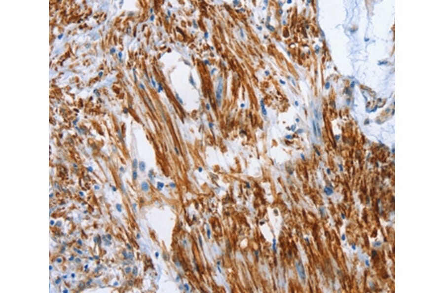 Immunohistochemistry - SHROOM2 Antibody from Signalway Antibody (37340) - Antibodies.com
