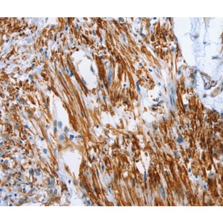 Immunohistochemistry - SHROOM2 Antibody from Signalway Antibody (37340) - Antibodies.com