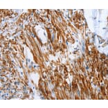 Immunohistochemistry - SHROOM2 Antibody from Signalway Antibody (37340) - Antibodies.com