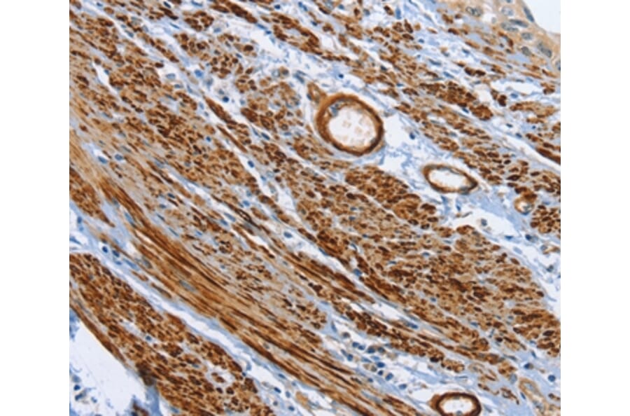 Immunohistochemistry - SHROOM2 Antibody from Signalway Antibody (37340) - Antibodies.com