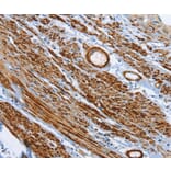 Immunohistochemistry - SHROOM2 Antibody from Signalway Antibody (37340) - Antibodies.com