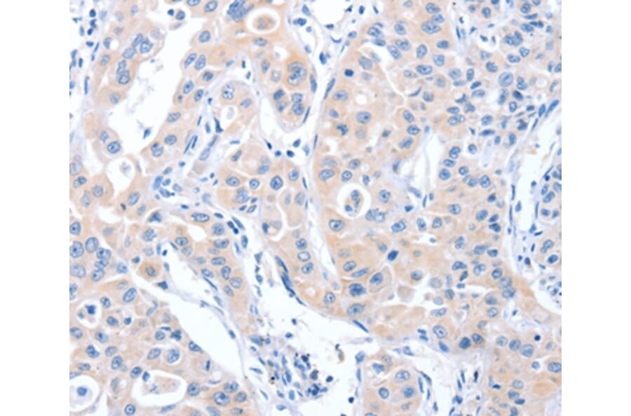 Immunohistochemistry - ARHGEF6 Antibody from Signalway Antibody (37342) - Antibodies.com