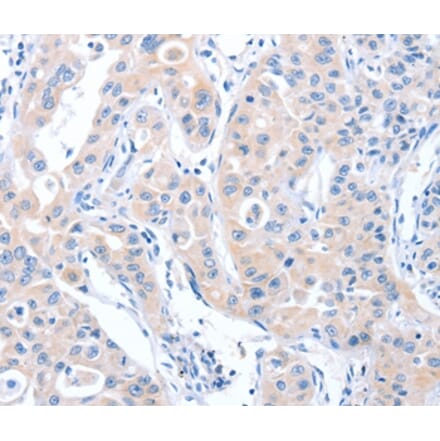 Immunohistochemistry - ARHGEF6 Antibody from Signalway Antibody (37342) - Antibodies.com
