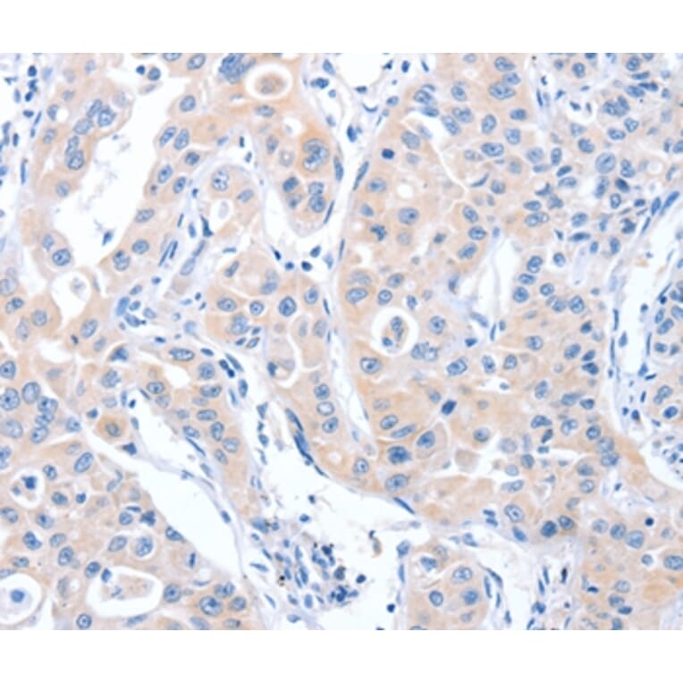 Immunohistochemistry - ARHGEF6 Antibody from Signalway Antibody (37342) - Antibodies.com