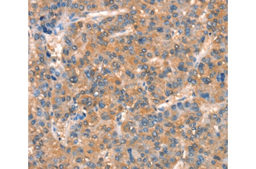 Immunohistochemistry - ARHGAP4 Antibody from Signalway Antibody (37353) - Antibodies.com