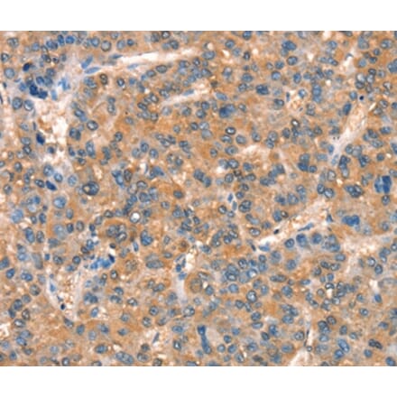 Immunohistochemistry - ARHGAP4 Antibody from Signalway Antibody (37353) - Antibodies.com