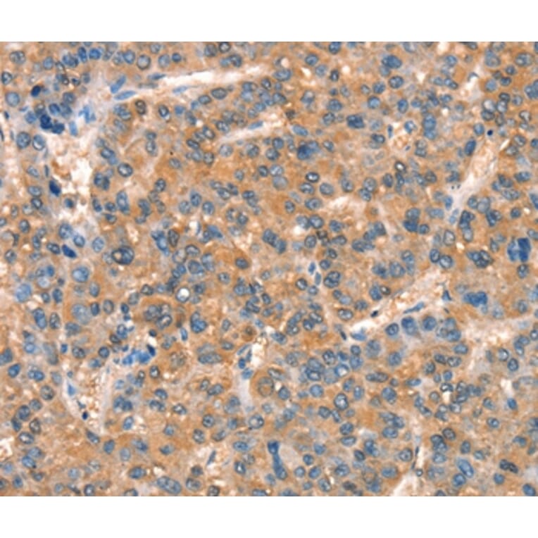 Immunohistochemistry - ARHGAP4 Antibody from Signalway Antibody (37353) - Antibodies.com