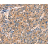Immunohistochemistry - ARHGAP4 Antibody from Signalway Antibody (37353) - Antibodies.com