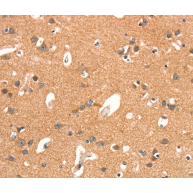 Immunohistochemistry - ARHGAP4 Antibody from Signalway Antibody (37353) - Antibodies.com