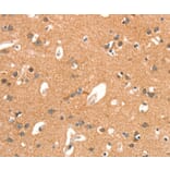 Immunohistochemistry - ARHGAP4 Antibody from Signalway Antibody (37353) - Antibodies.com