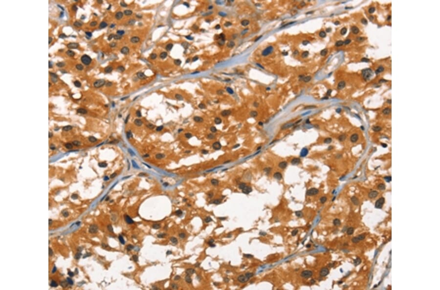 Immunohistochemistry - DEFA1/3 Antibody from Signalway Antibody (37410) - Antibodies.com