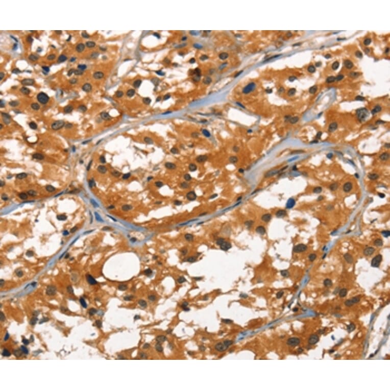 Immunohistochemistry - DEFA1/3 Antibody from Signalway Antibody (37410) - Antibodies.com