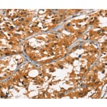 Immunohistochemistry - DEFA1/3 Antibody from Signalway Antibody (37410) - Antibodies.com
