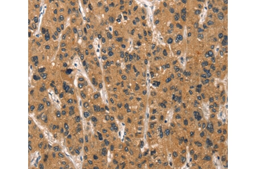 Immunohistochemistry - DEFA1/3 Antibody from Signalway Antibody (37410) - Antibodies.com