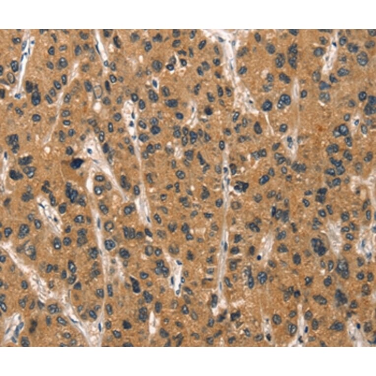 Immunohistochemistry - DEFA1/3 Antibody from Signalway Antibody (37410) - Antibodies.com