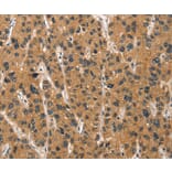 Immunohistochemistry - DEFA1/3 Antibody from Signalway Antibody (37410) - Antibodies.com