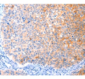 Immunohistochemistry - CCDC88A Antibody from Signalway Antibody (37414) - Antibodies.com