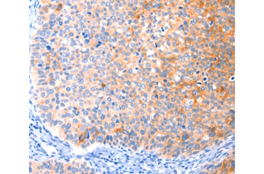 Immunohistochemistry - CCDC88A Antibody from Signalway Antibody (37414) - Antibodies.com