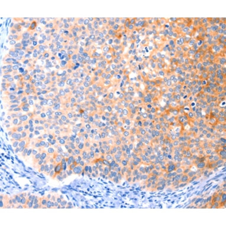 Immunohistochemistry - CCDC88A Antibody from Signalway Antibody (37414) - Antibodies.com