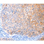 Immunohistochemistry - CCDC88A Antibody from Signalway Antibody (37414) - Antibodies.com