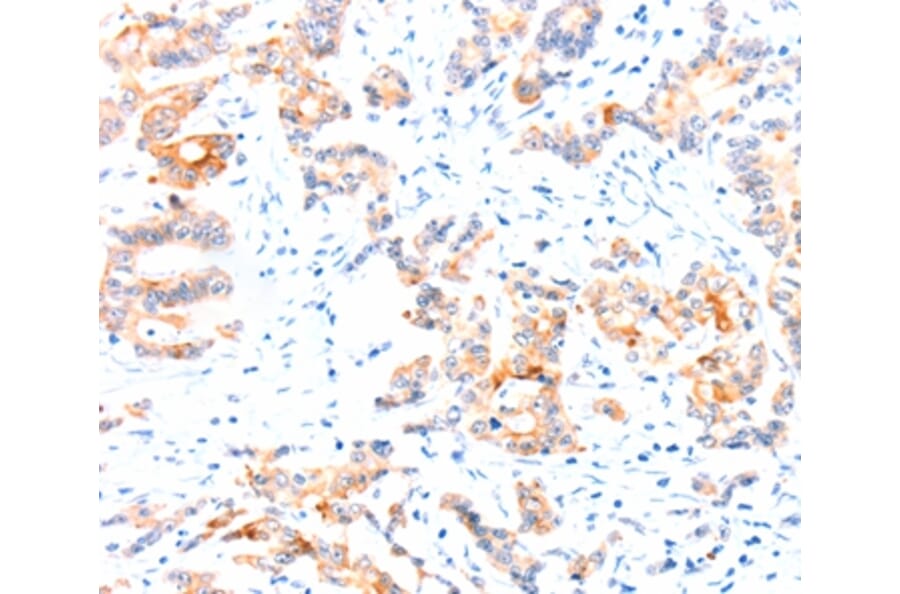 Immunohistochemistry - CCDC88A Antibody from Signalway Antibody (37414) - Antibodies.com