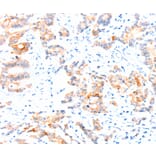 Immunohistochemistry - CCDC88A Antibody from Signalway Antibody (37414) - Antibodies.com