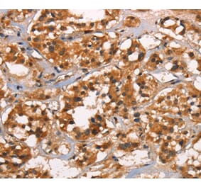 Immunohistochemistry - CABLES2 Antibody from Signalway Antibody (37450) - Antibodies.com