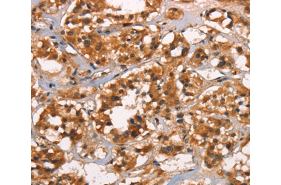 Immunohistochemistry - CABLES2 Antibody from Signalway Antibody (37450) - Antibodies.com