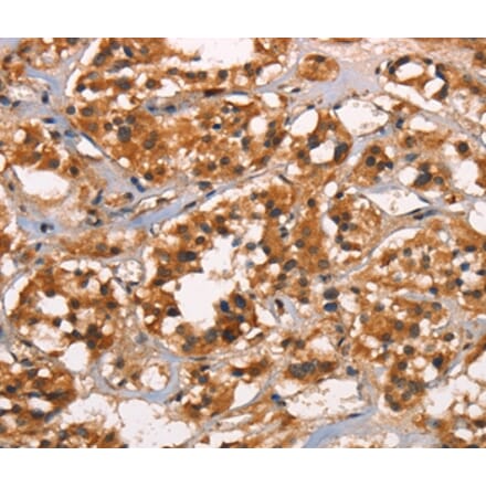 Immunohistochemistry - CABLES2 Antibody from Signalway Antibody (37450) - Antibodies.com