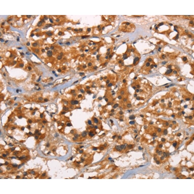 Immunohistochemistry - CABLES2 Antibody from Signalway Antibody (37450) - Antibodies.com