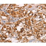 Immunohistochemistry - CABLES2 Antibody from Signalway Antibody (37450) - Antibodies.com