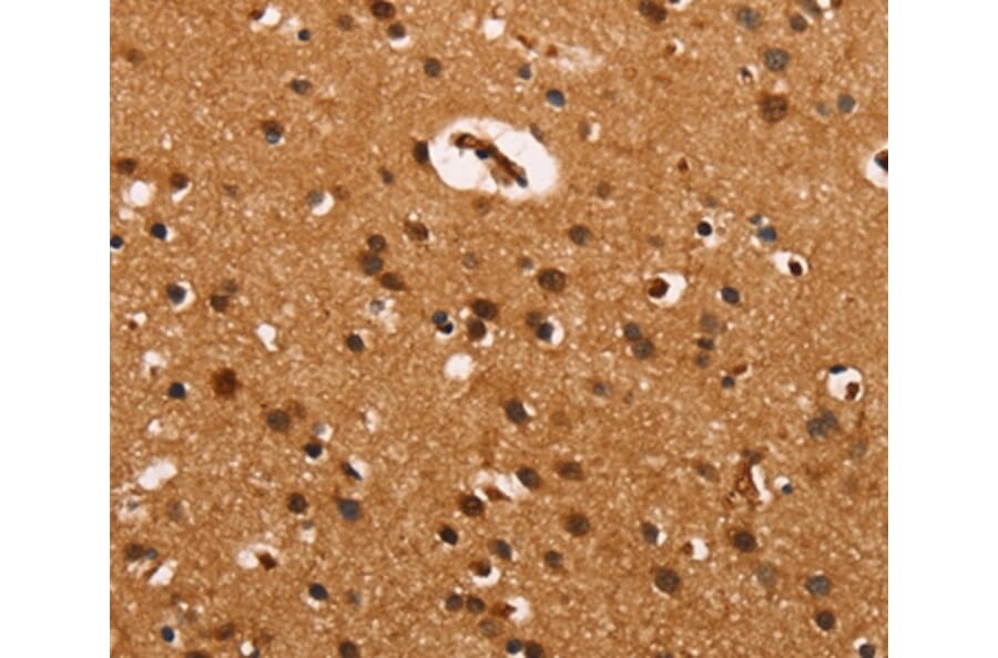 Immunohistochemistry - CABLES2 Antibody from Signalway Antibody (37450) - Antibodies.com