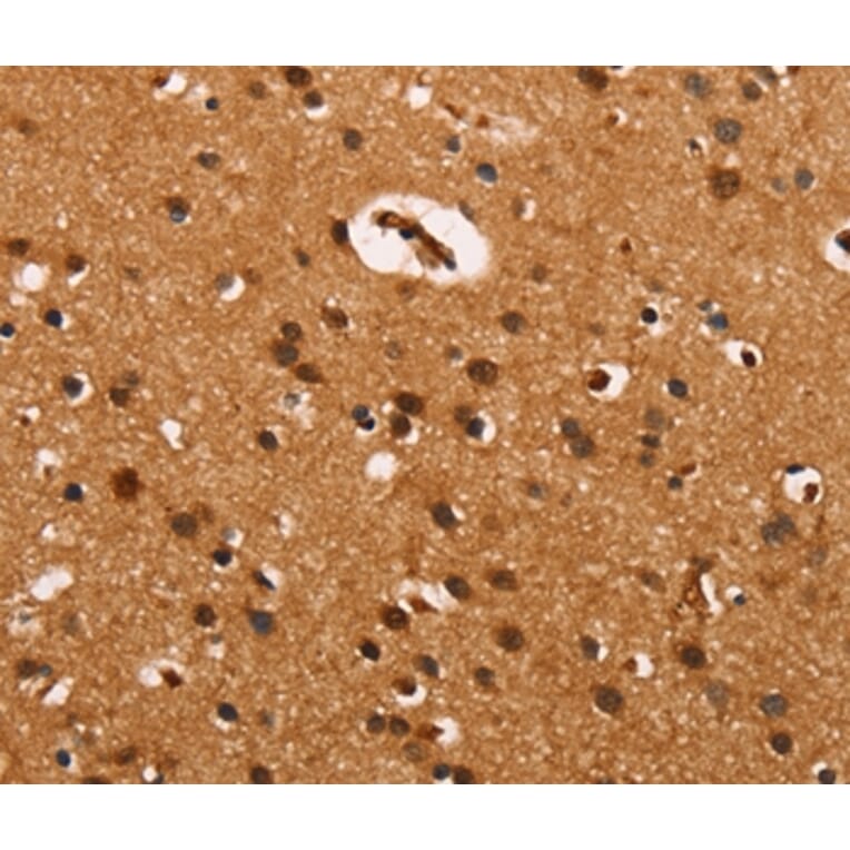 Immunohistochemistry - CABLES2 Antibody from Signalway Antibody (37450) - Antibodies.com