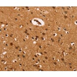 Immunohistochemistry - CABLES2 Antibody from Signalway Antibody (37450) - Antibodies.com