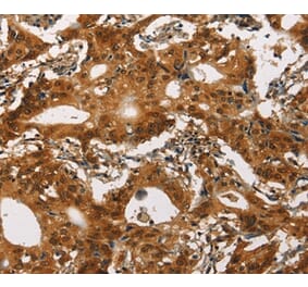 Immunohistochemistry - CACNA1C Antibody from Signalway Antibody (37451) - Antibodies.com