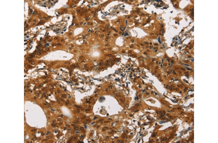 Immunohistochemistry - CACNA1C Antibody from Signalway Antibody (37451) - Antibodies.com