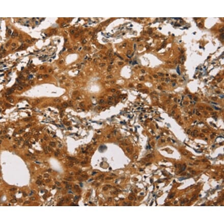 Immunohistochemistry - CACNA1C Antibody from Signalway Antibody (37451) - Antibodies.com