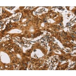 Immunohistochemistry - CACNA1C Antibody from Signalway Antibody (37451) - Antibodies.com