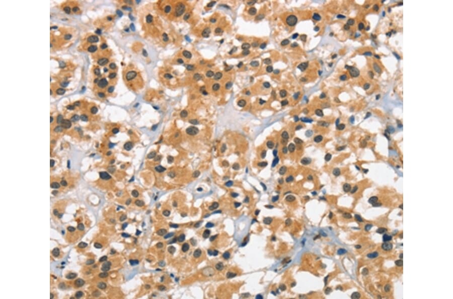 Immunohistochemistry - CACNA1C Antibody from Signalway Antibody (37451) - Antibodies.com