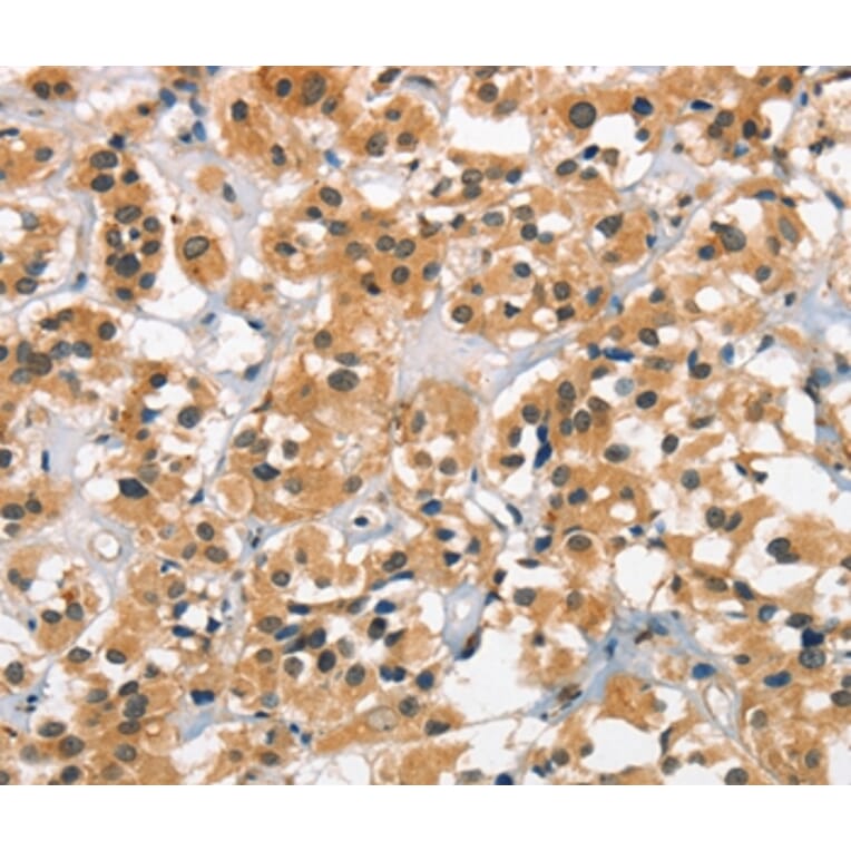 Immunohistochemistry - CACNA1C Antibody from Signalway Antibody (37451) - Antibodies.com