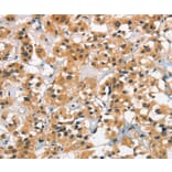 Immunohistochemistry - CACNA1C Antibody from Signalway Antibody (37451) - Antibodies.com