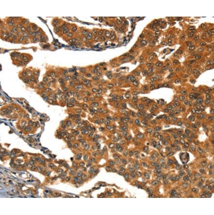 Immunohistochemistry - CACNA1E Antibody from Signalway Antibody (37453) - Antibodies.com