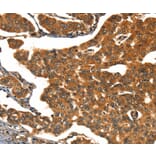 Immunohistochemistry - CACNA1E Antibody from Signalway Antibody (37453) - Antibodies.com