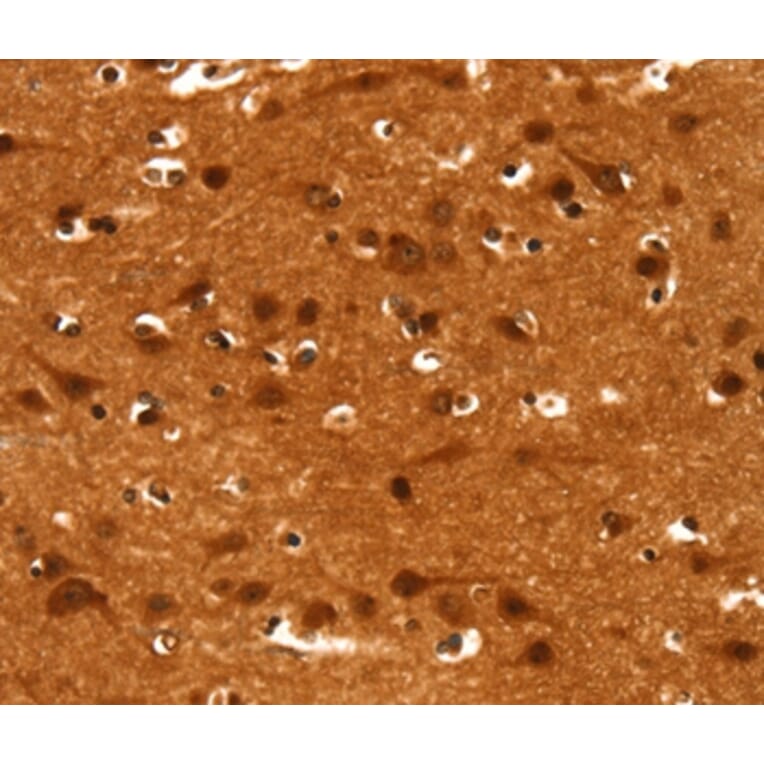 Immunohistochemistry - CACNA1E Antibody from Signalway Antibody (37453) - Antibodies.com