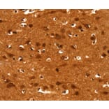 Immunohistochemistry - CACNA1E Antibody from Signalway Antibody (37453) - Antibodies.com