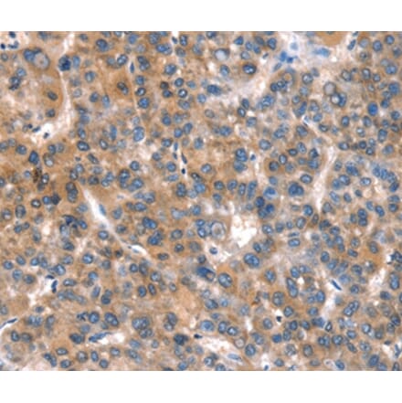 Immunohistochemistry - CACNA1A Antibody from Signalway Antibody (37454) - Antibodies.com