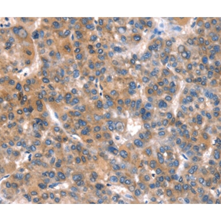 Immunohistochemistry - CACNA1A Antibody from Signalway Antibody (37454) - Antibodies.com