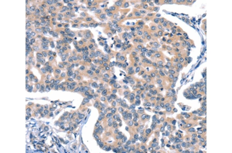 Immunohistochemistry - CACNA1A Antibody from Signalway Antibody (37454) - Antibodies.com