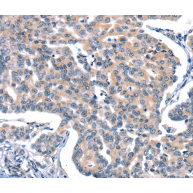 Immunohistochemistry - CACNA1A Antibody from Signalway Antibody (37454) - Antibodies.com